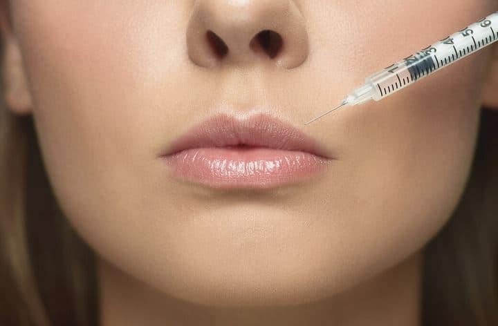 حقن الفيلر للشفاه والخدود