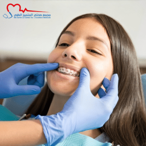 تقويم الأسنان