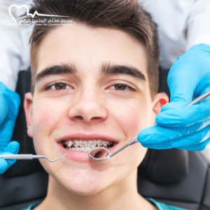 تقويم الأسنان