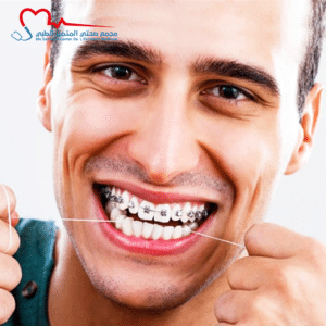 تقويم الأسنان