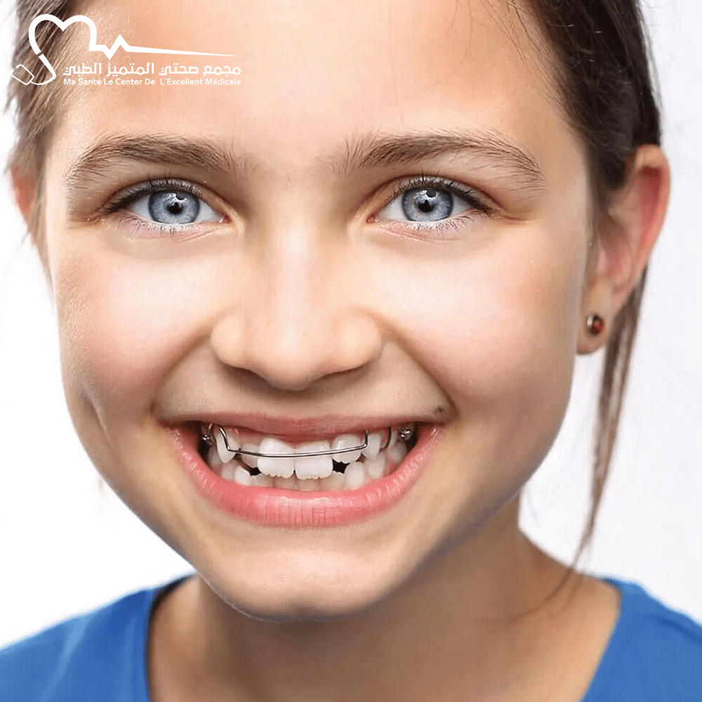 تقويم الأسنان للأطفال