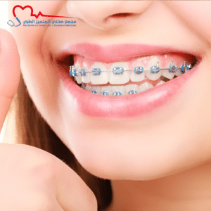 تقويم الأسنان للأطفال