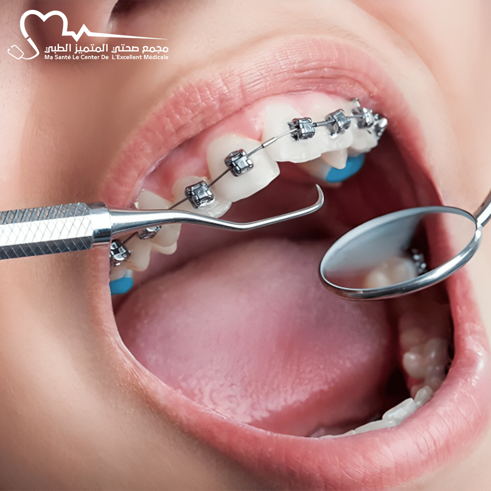 العناية بالأسنان