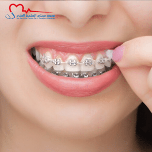 العناية بالأسنان