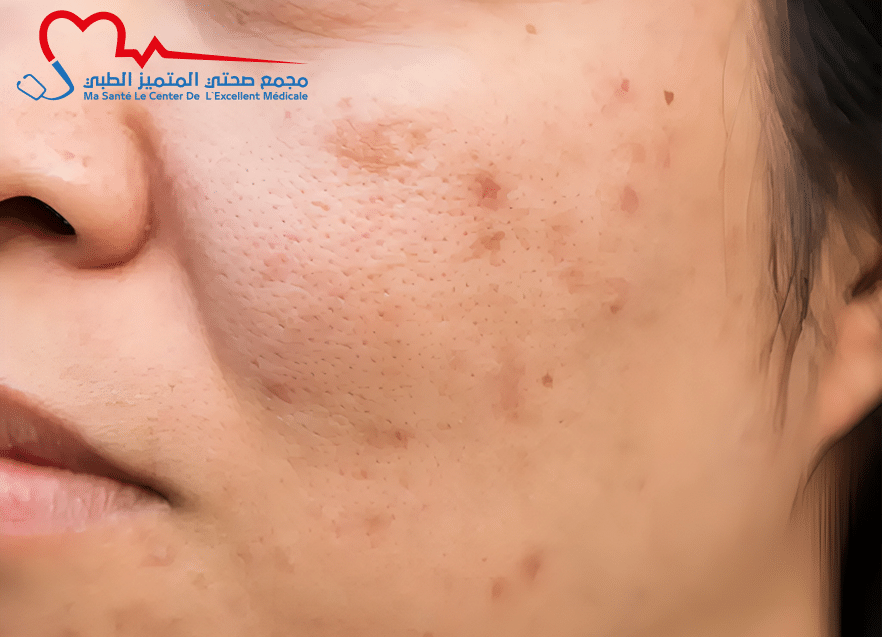 التصبغات الجلدية