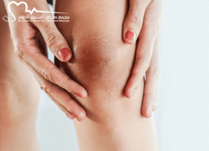 التصبغات الجلدية